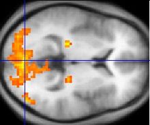 Monochrome fMRI image of a horizontal cross-section of a human brain. A few regions, mostly to the rear, are highlighted in orange and yellow.