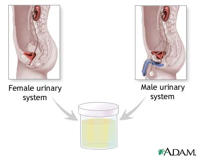 Urine test