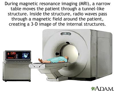 MRI scans