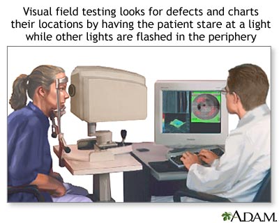 Visual field test