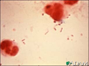 Haemophilus influenza organism