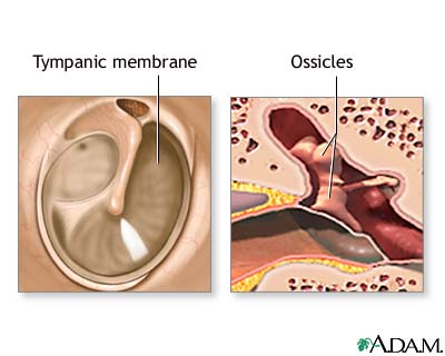 Normal anatomy