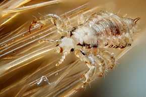 Vue microscopique d'un animal transparent à gros abdomen plein de sang et 6 pattes accrochées des cheveux