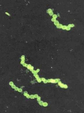 Description de l'image Sulphide bacteria crop.jpg.